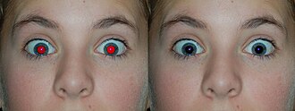 A photograph of a human with the red-eye effect and its correction right next to it