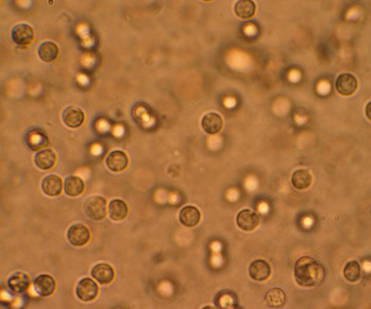 Pyuria.JPG