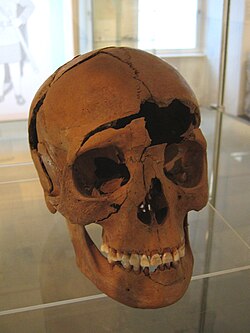 Skull of a 20- to 30-year-old decapitated woman of the 3rd century AD, in Germany. Cutting marks above the right eye socket show the head has been scalped.
