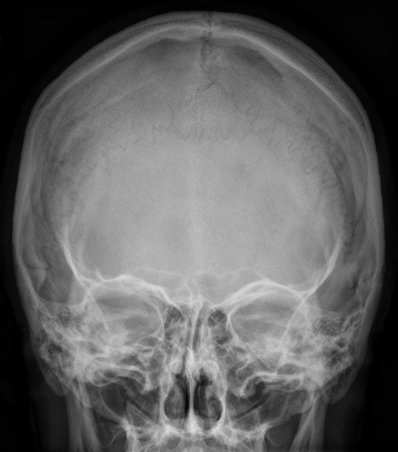 Inkabein - Roentgen.jpg