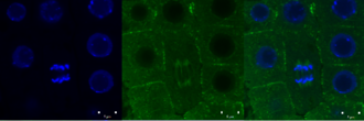 Green signal from anti-tubulin antibody conjugated with Alexa Fluor 488) and nuclei (blue signal from DNA stained with DAPI) in root meristem cells 4-day-old Arabidopsis thaliana (Col-0). Scale bar: 5 um.