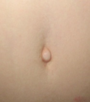 An outie navel