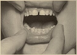 Teeth