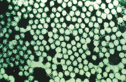 Electron micrograph of Foot-and-mouth disease virus