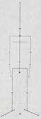 a 1½-year-old child