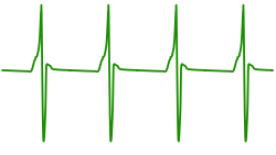 A gymnotiform electrolocation waveform