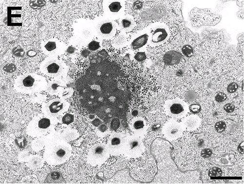 Electron micrograph of virus factory in an amoeba co-infected with Zamilon and Mont1 (scale bar: 0.1 μm)