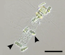 Epiphytic Calothrix cyanobacteria (arrows) in symbiosis with a Chaetoceros diatom (scale bar 50 μm)