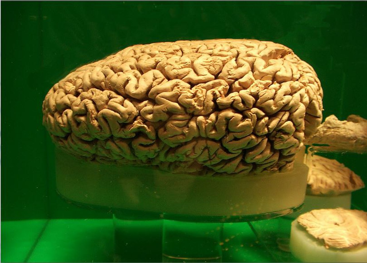 Preserved sperm whale brain.jpg