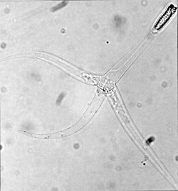 Myxozoans such as Myxobolus cerebralis are single-celled parasites, never more than 20 μm across.