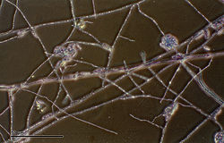 A photograph of a stained culture of Haematonectria haematococca