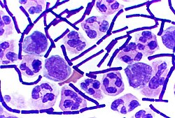 Depicts the necessity in understanding the metabolism of bacteria in order to see how their proliferation effects the climate, along with other effects that it might have.