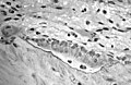 Light micrograph of decalcified cancellous bone displaying osteoblasts actively synthesizing osteoid, containing two osteocytes