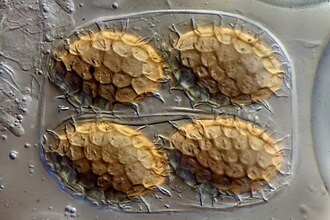 Microscope view of a transparent sac (ascus) holding four oval, golden-brown spores. The spores are covered with a raised, net-like pattern that looks like a mosaic of tiny scales.