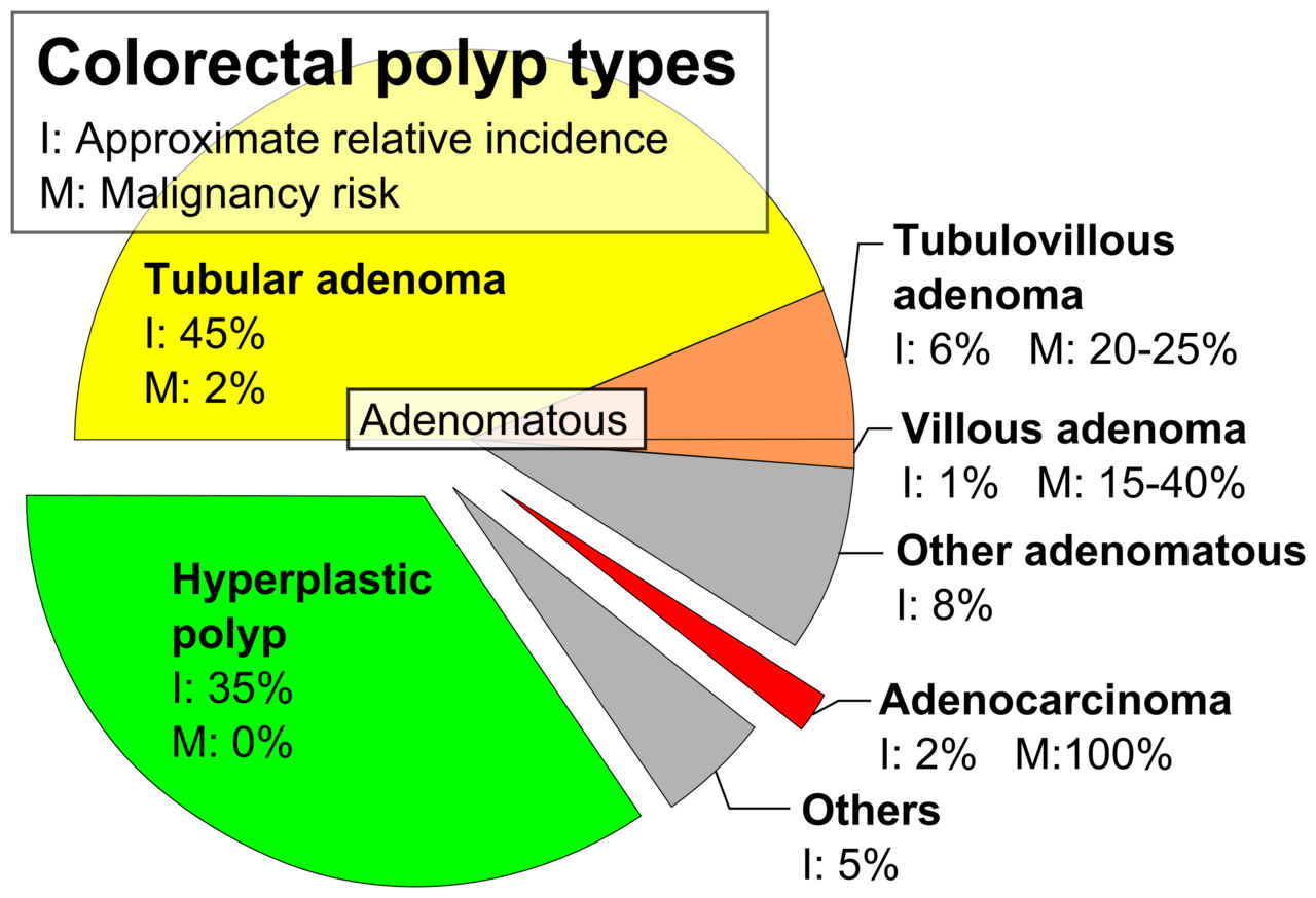 Pie chart of colorectal polyp etiologies.png