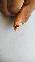 Seedling with seed coat
