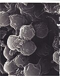 Bodo caudatus cysts