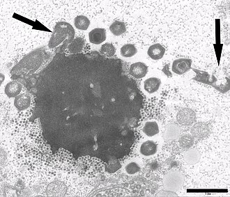 Electron micrograph of a virus factory in an amoeba co-infected with Zamilon virophage (small particles) and Mont1. Arrows show abnormal Mont1 particles (scale bar: 0.1 μm)