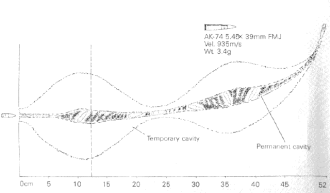 AK-74 5.45x39mm wound ballistics