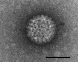 Negatively stained Bluetongue virus–like particle that caused a cytopathic effect in BHK-21 cells. Scale bar = 50 nm