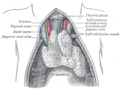 The thymus of a full-term fetus, exposed in situ