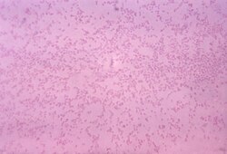 Gram-stained photomicrograph depicting numerous "Pasteurella multocida" bacteria
