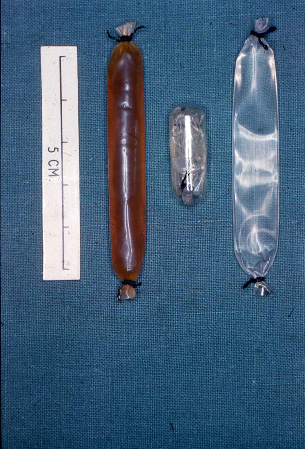 Stool Dialysis.jpg
