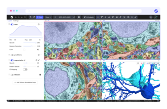 The Webknossos UI showcasing a volume EM dataset.