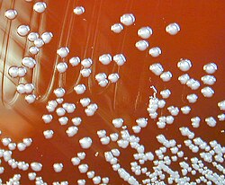 "Burkholderia pseudomallei" colonies on a blood agar plate