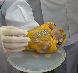 Image of a heart appearing enlarged