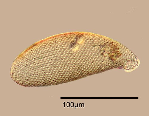 Shell of Cyphoderia ampulla, composed of circular, siliceous plates produced by the amoeba