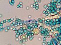 Fruit mold with spores and distinguishable cellular growth (2000x)