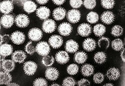 Transmission electron micrograph of rotavirus virions