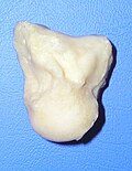 Capitate bone of the left hand. Radial surface (thumb-side surface)