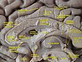 Medial sagittal section of the human brain.