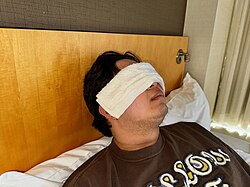 warm compress demonstrated with a warm, wet towel