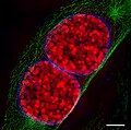 Two mouse cell nuclei in prophase.