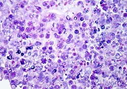Many clusters of dark violet organisms that have central clearing
