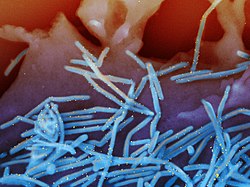 Filamentous RSV particles