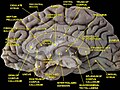 Median sagittal section of the human brain.