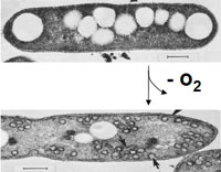 Rhodobacter sphaeroides