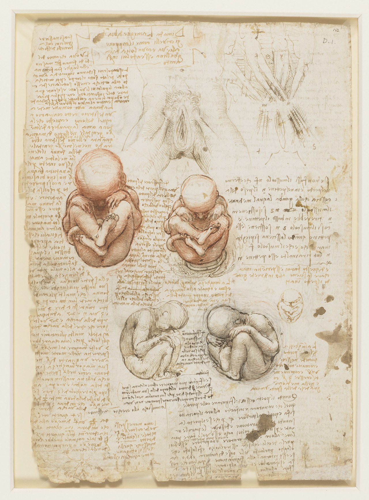 Leonardo da Vinci - RCIN 919101, Recto The fetus, and the muscles attached to the pelvis.jpg
