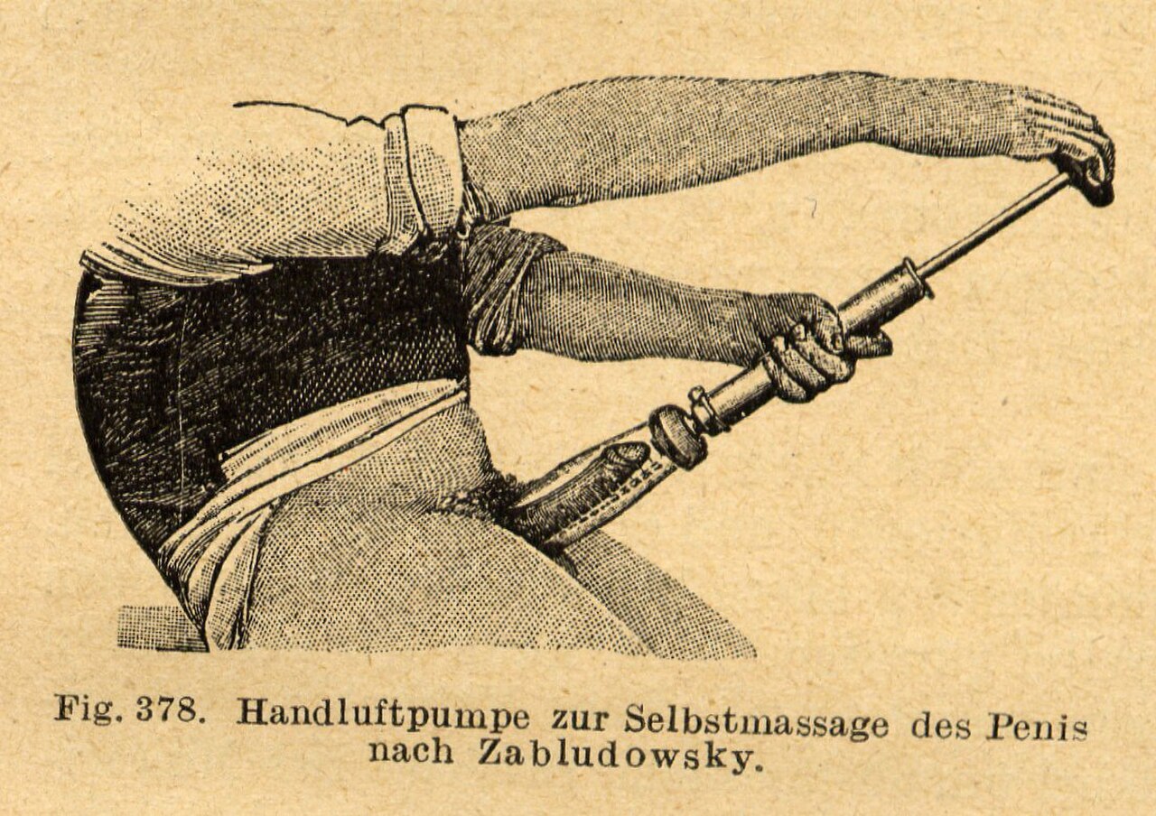 Old penis pump p.718.jpg