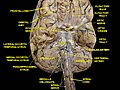 Cerebrum.Inferior view. Deep dissection.