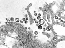 TEM micrograph of Lassa virus virions