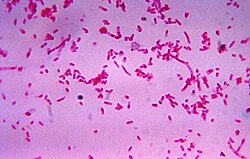 "Fusobacterium novum" in liquid culture