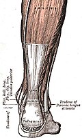 Diagram of an Achilles tendon