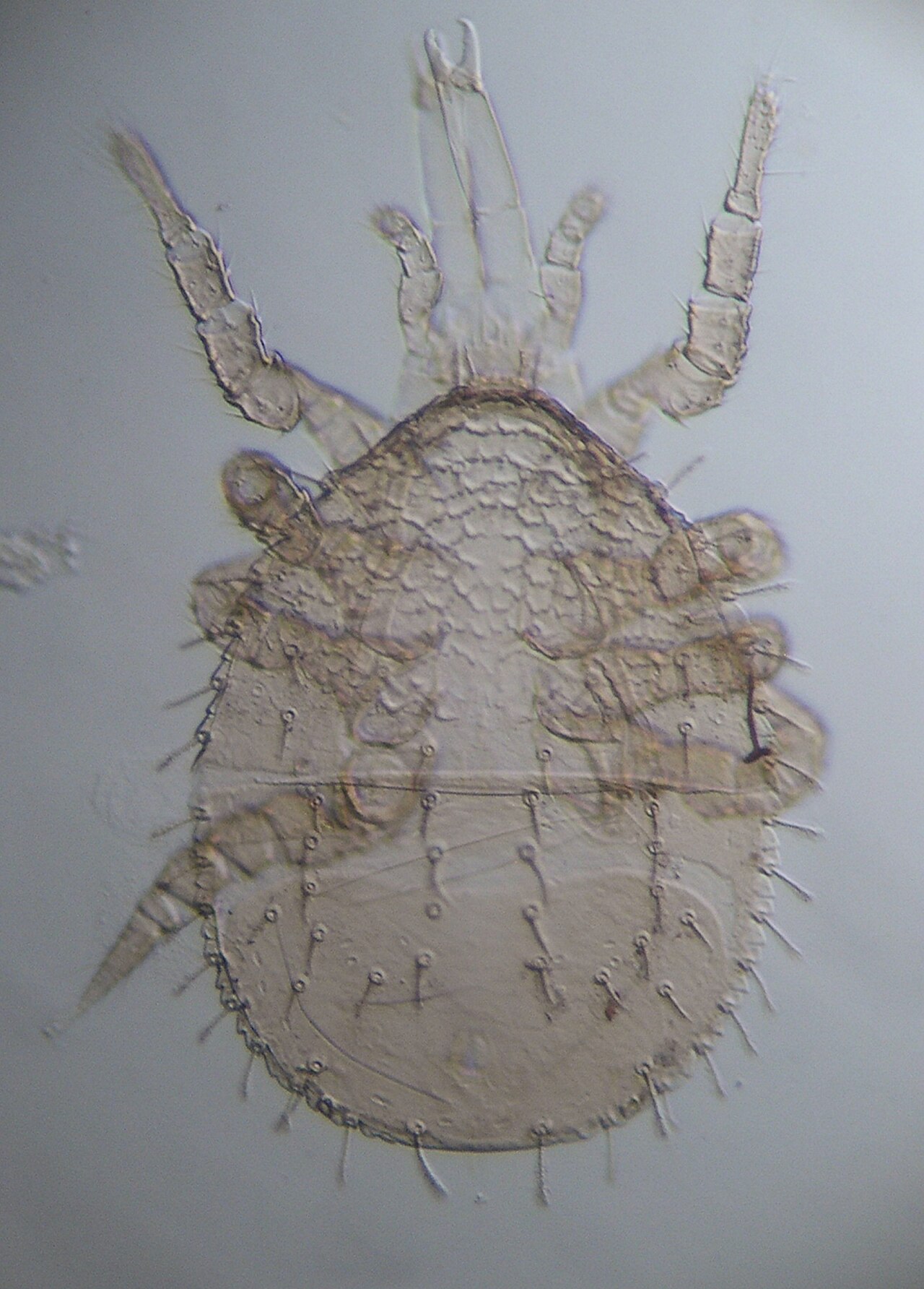 Parazercon radiatus.jpg