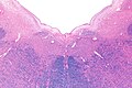Micrograph of the posterior portion of the open part of the medulla oblongata, showing the fourth ventricle (top of image) and the nuclei of CN XII (medial) and CN X (lateral). H&E-LFB stain.