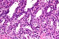 High magnification micrograph of seminal vesicle. H&E stain.